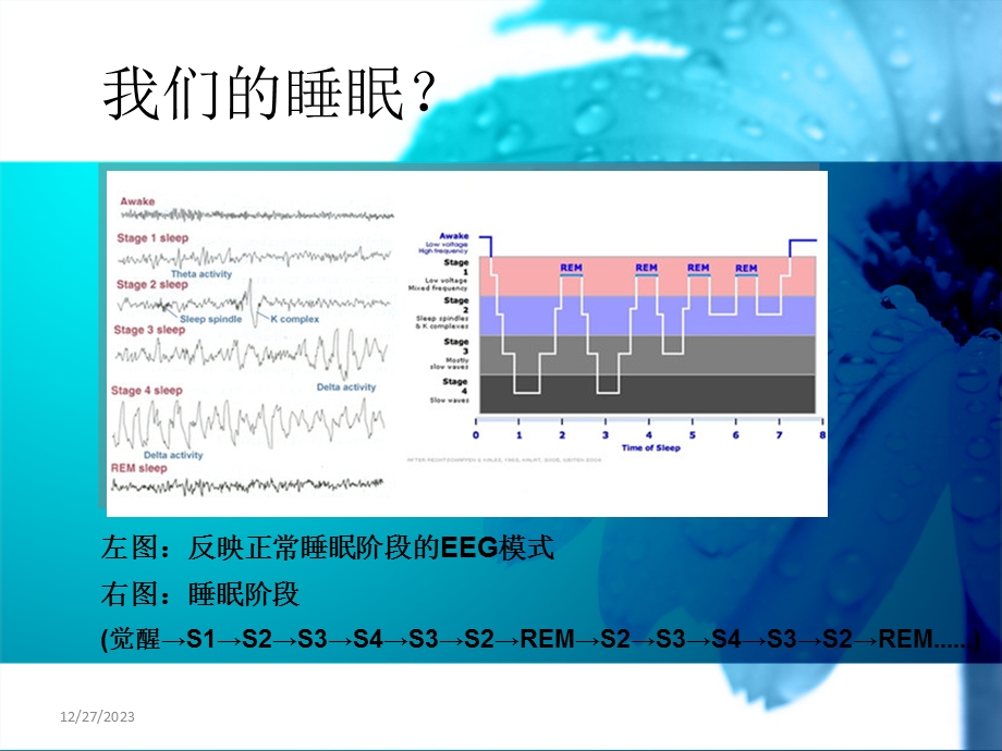 睡眠障碍ppt.ppt_第2页