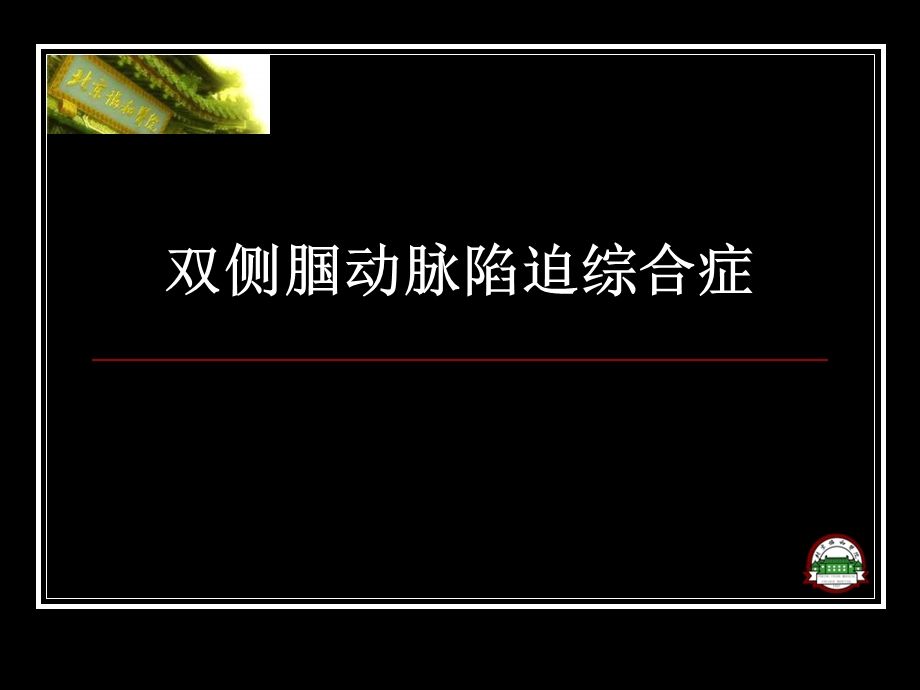 双侧腘动脉陷迫综合症.ppt_第1页