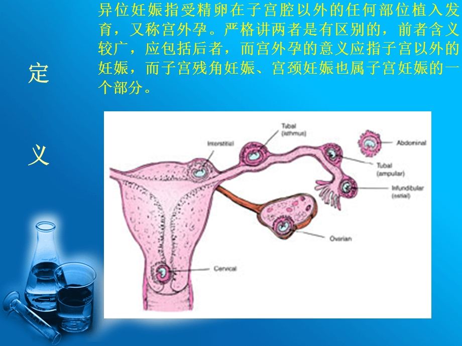 妊娠黄体与宫外孕的鉴别诊断.ppt_第3页