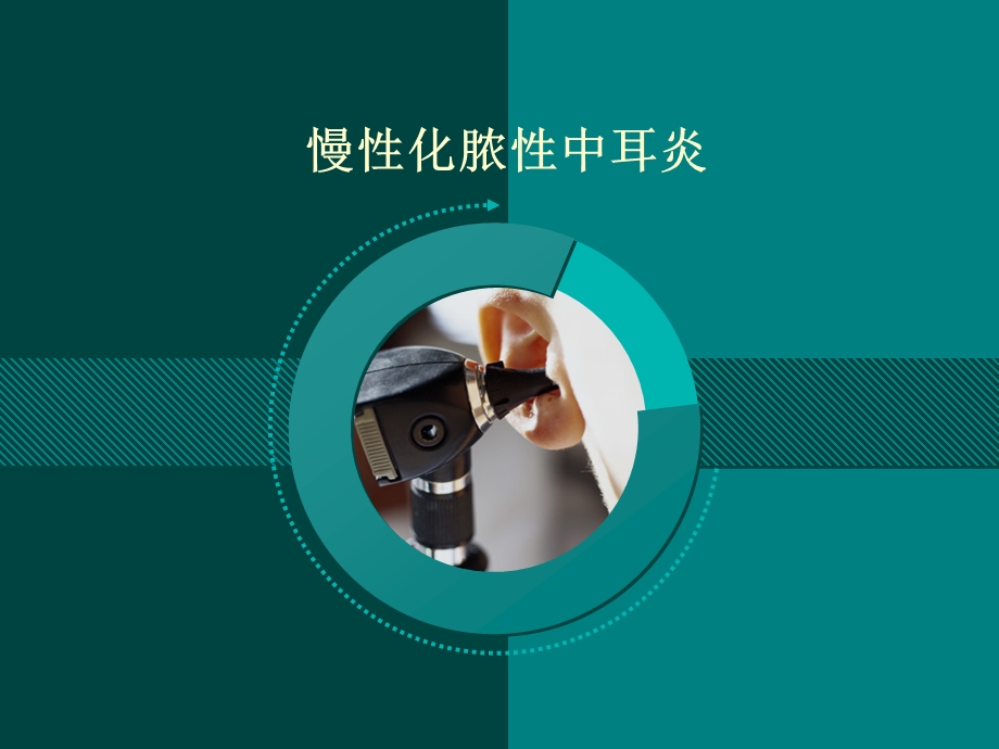 胆脂瘤型中耳炎.ppt_第1页