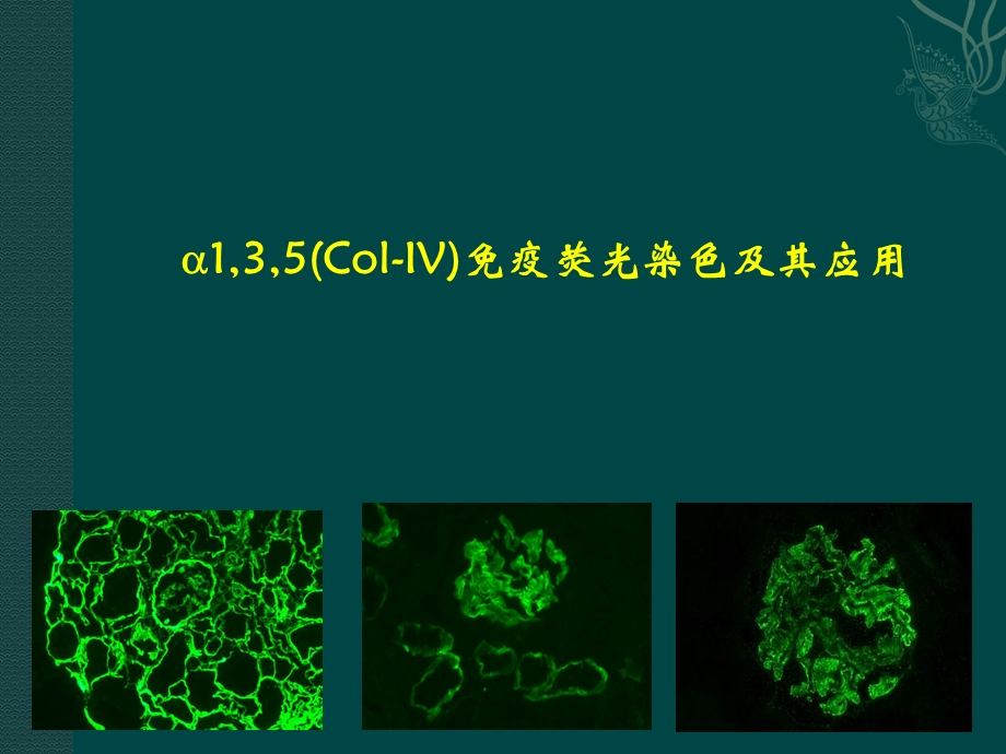 肾脏病理.ppt_第1页