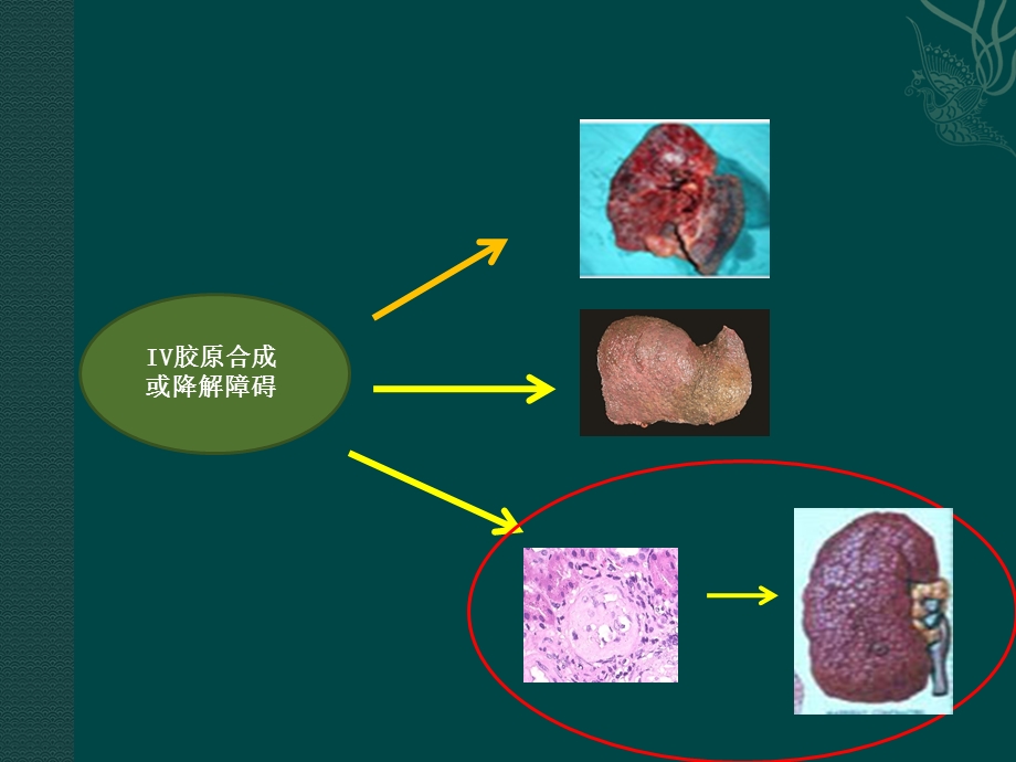 肾脏病理.ppt_第3页