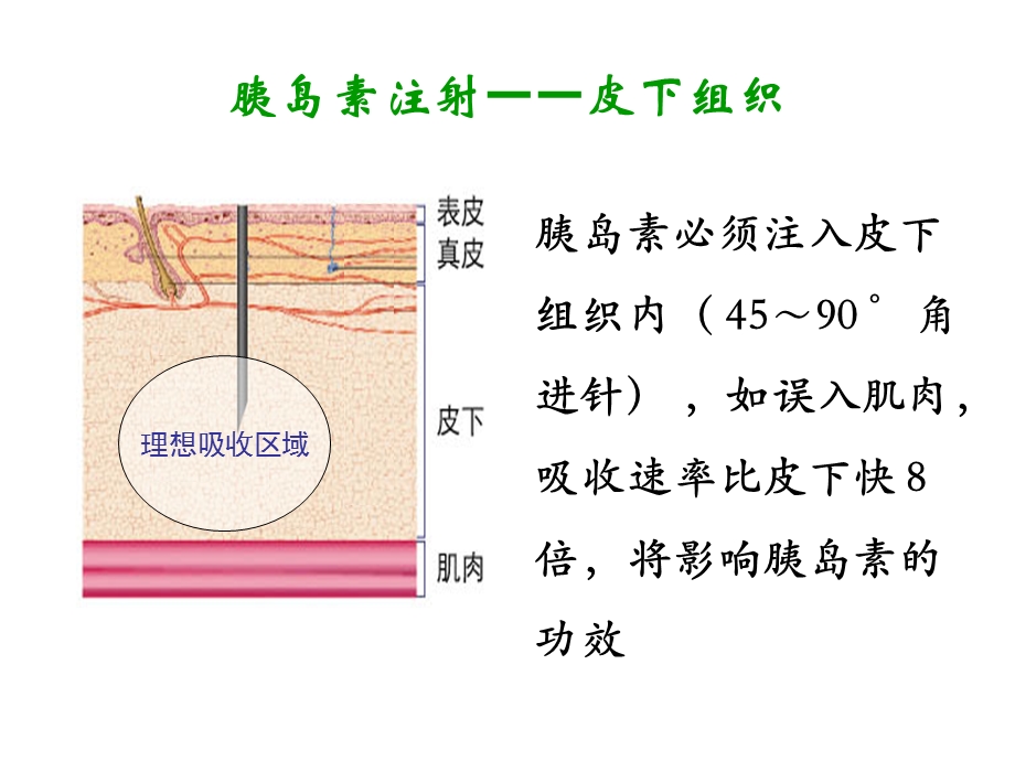 胰岛素注射及注意事项.ppt_第2页