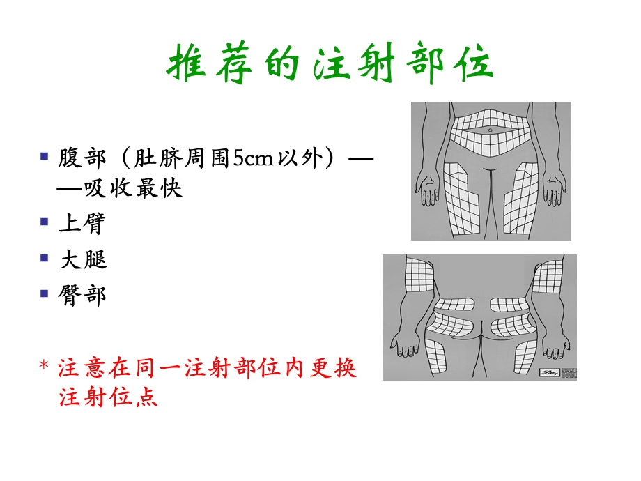 胰岛素注射及注意事项.ppt_第3页