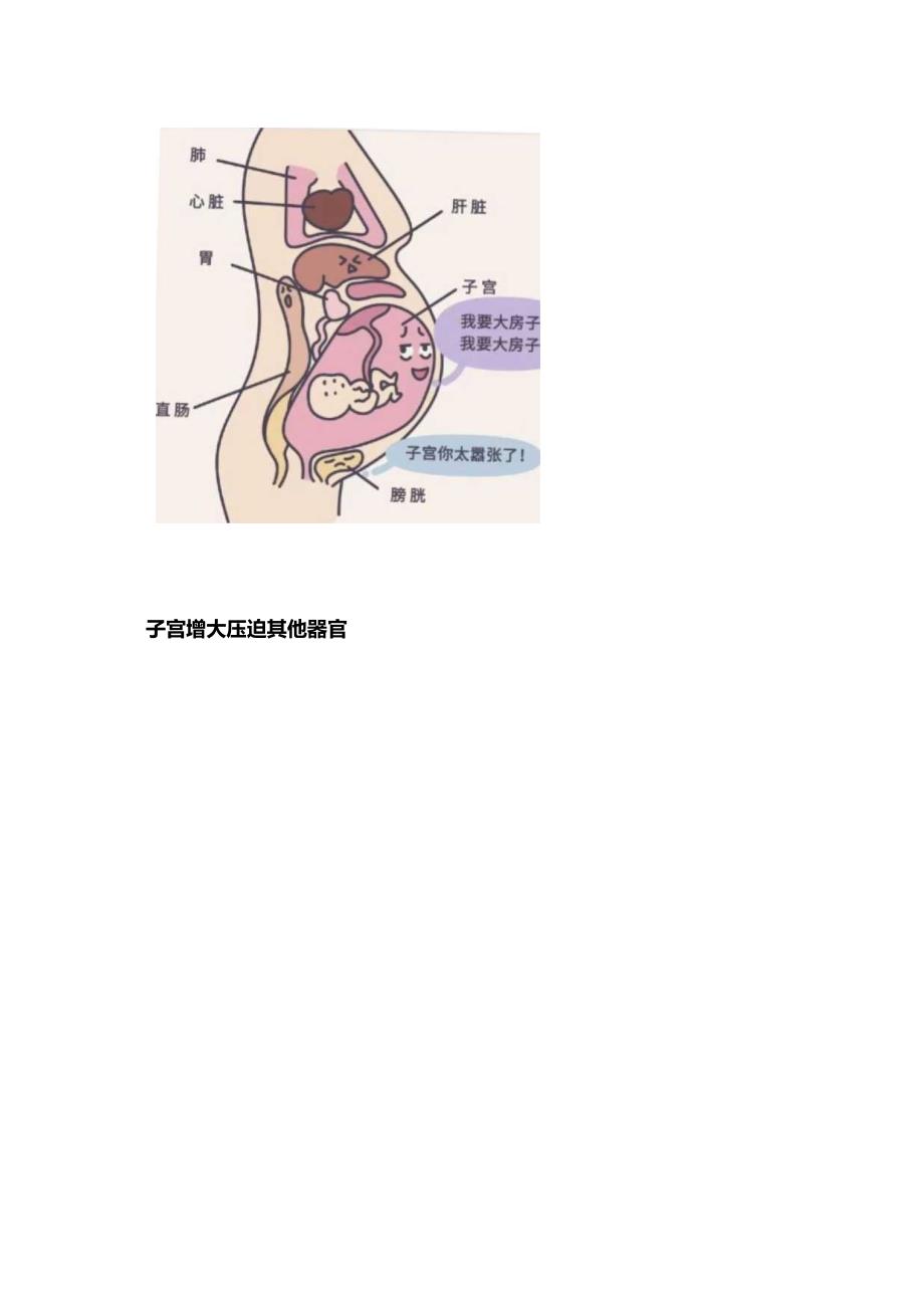 2023妊娠期尿路感染的健康宣教.docx_第2页