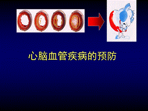 防治心脑血管疾病健康讲座(绝对实用).ppt