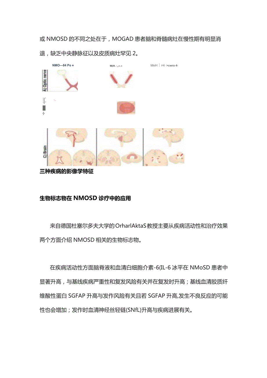 ECTRIMS 2023： NMOSD诊疗新进展.docx_第2页