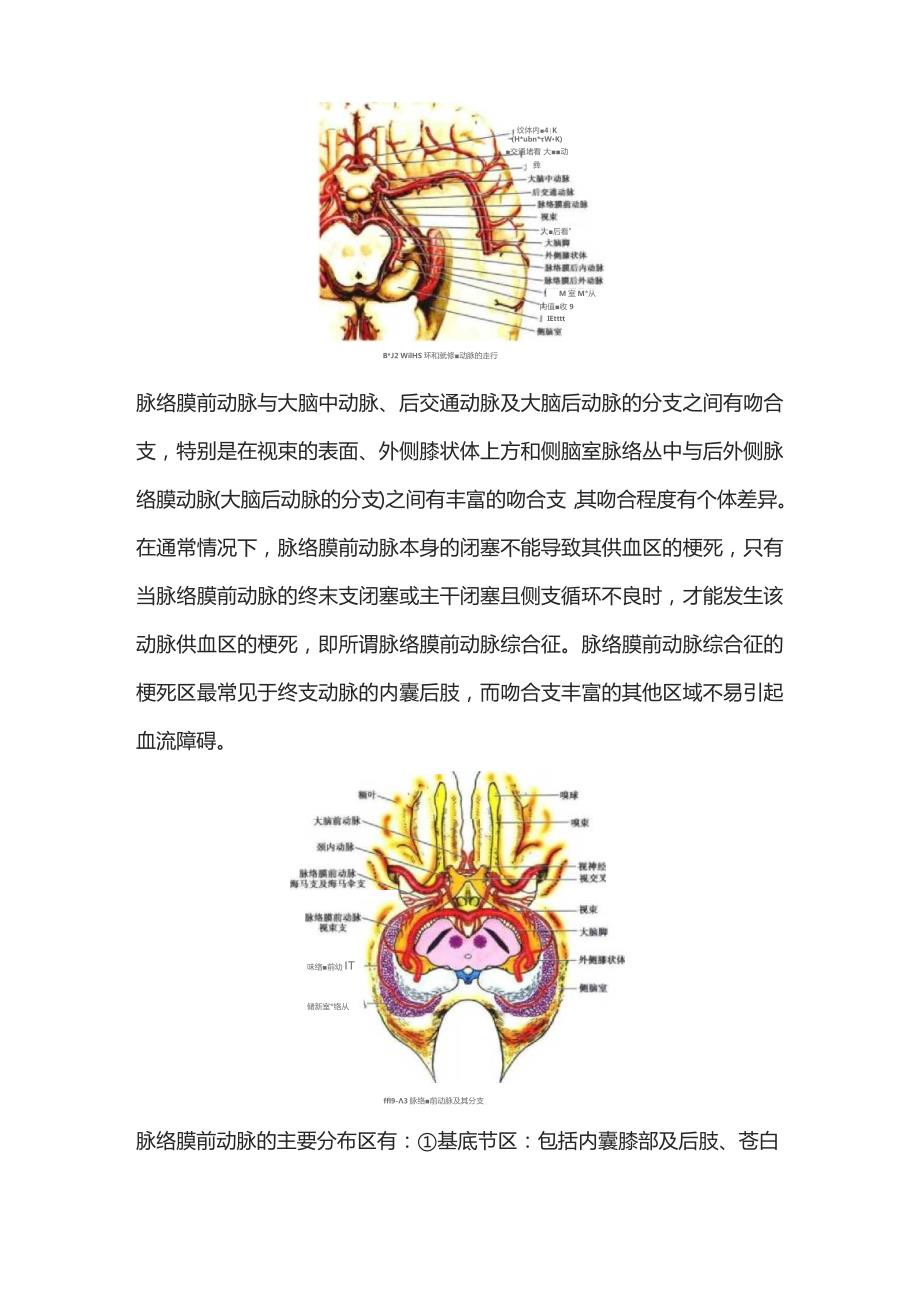 2023脉络膜前动脉的解剖及受损表现.docx_第2页