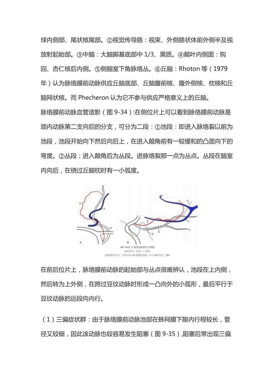 2023脉络膜前动脉的解剖及受损表现.docx_第3页