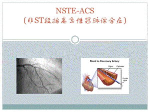 非ST段抬高性急性冠脉综合症.ppt