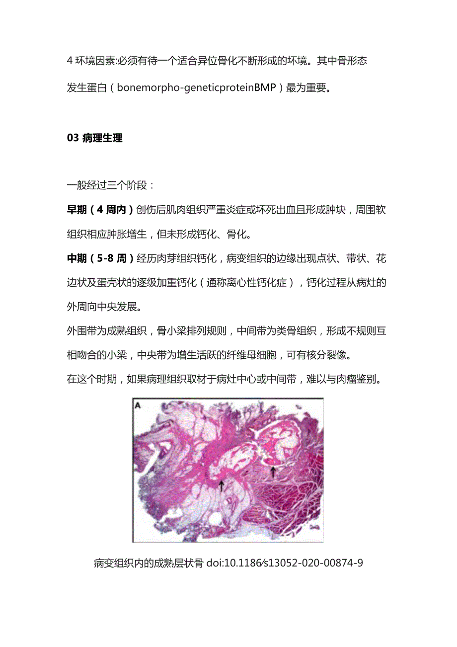 2023骨化性肌炎研究进展.docx_第2页