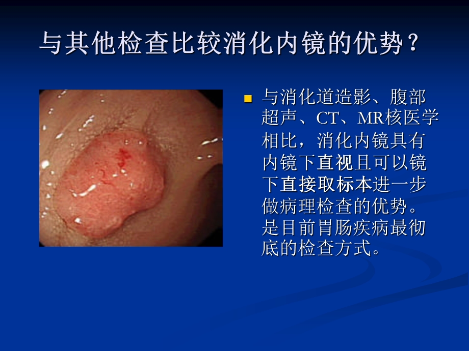 讲课消化内镜概述及常见病内镜下治疗.ppt_第3页