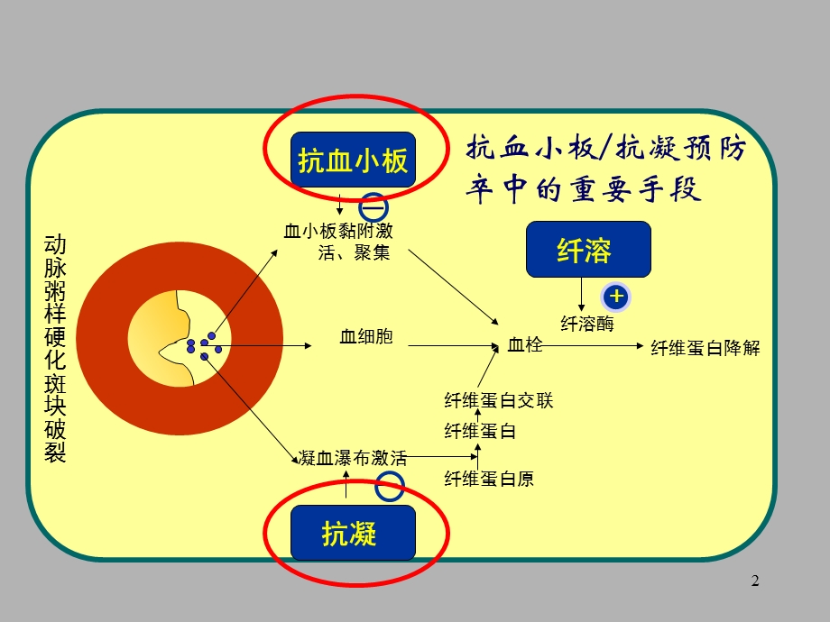 缺血性脑卒中／TIA 二级预防抗血小板药物规范化应用的中国专家共识.ppt_第2页