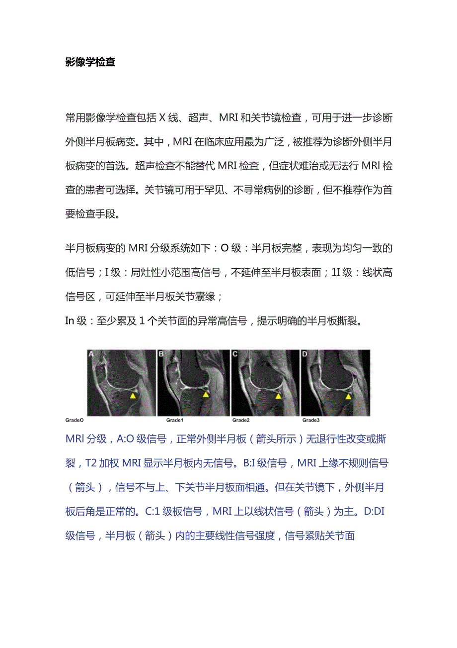 2023外侧半月板病变的诊断与治疗.docx_第3页