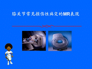 膝关节常见损伤性病变的MR表现.ppt