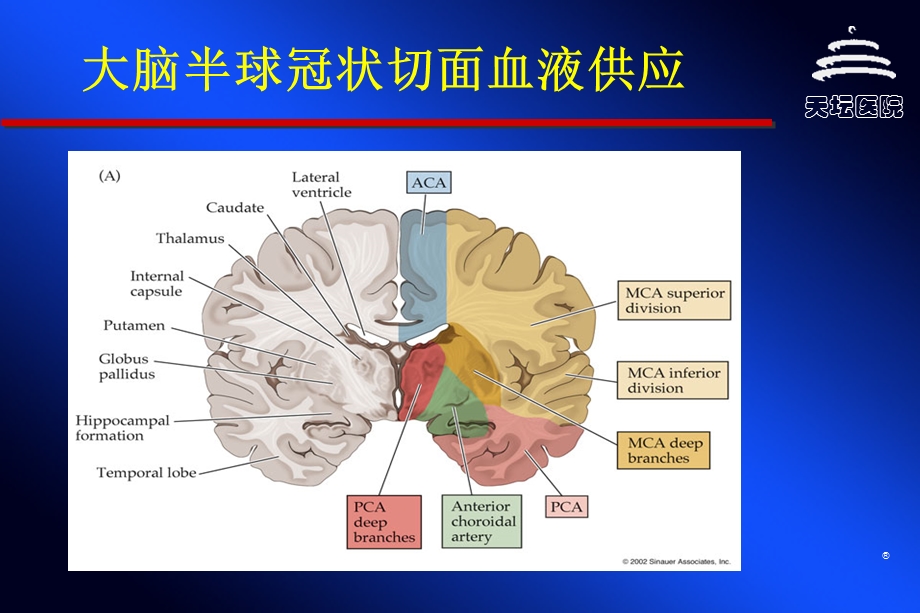 脑血管病与侧枝循环.ppt_第3页