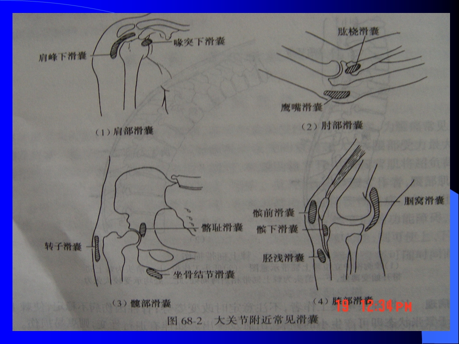 运动系统慢性损伤.ppt_第3页