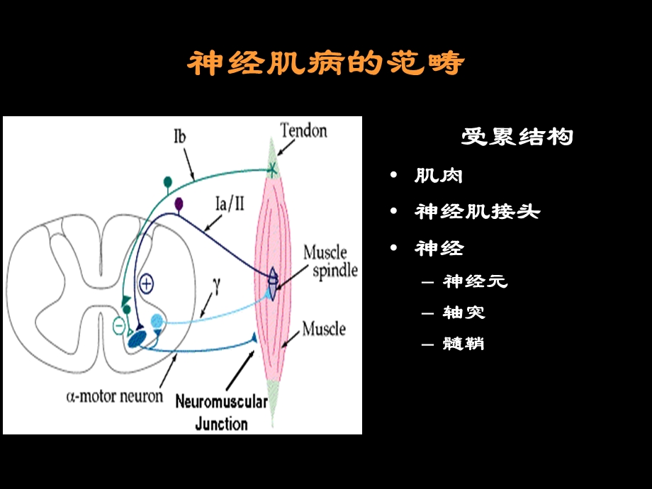 神经肌病概述.ppt_第2页