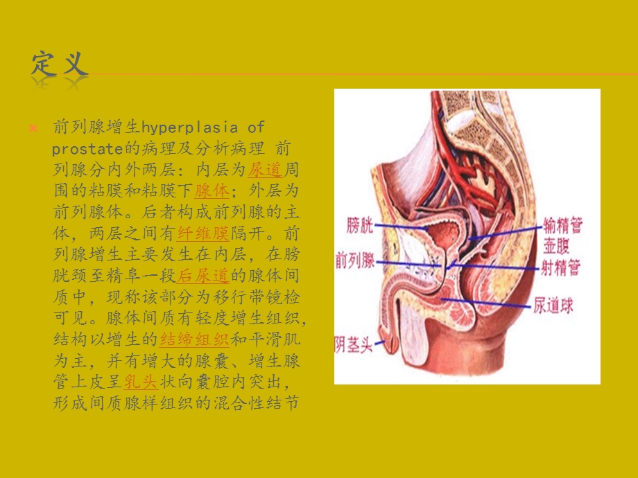 前列腺增生.ppt.ppt_第3页