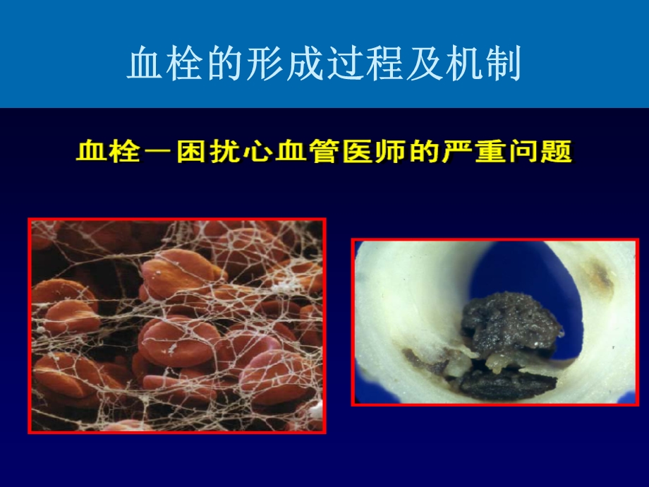 基因多态性与氯吡格雷的个体化应用.ppt.ppt_第2页