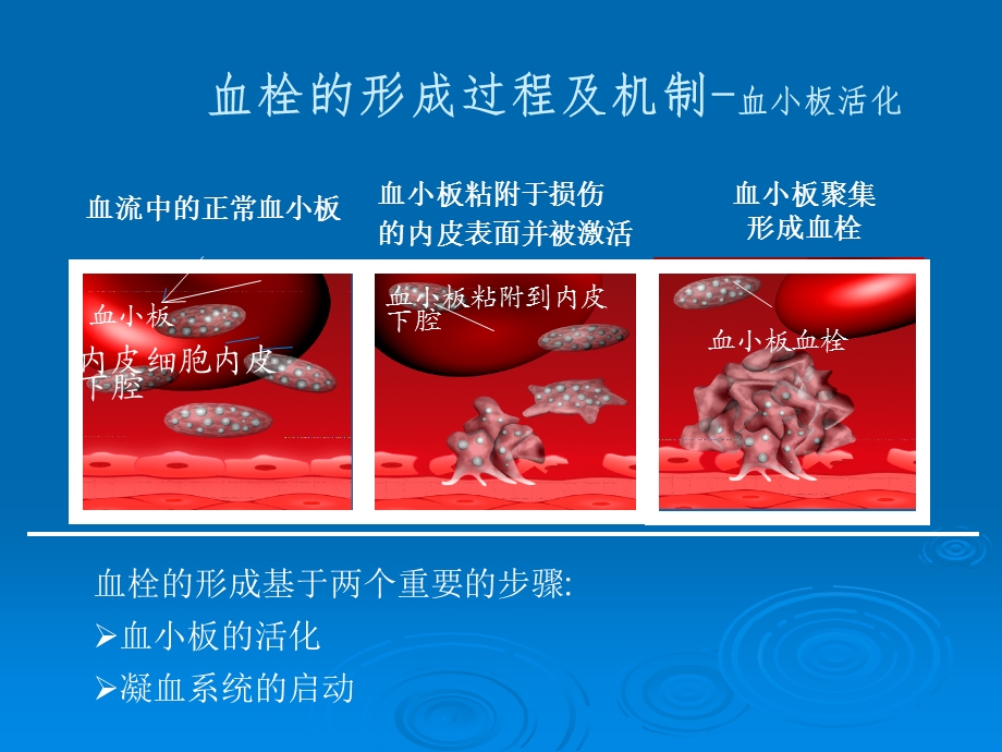 基因多态性与氯吡格雷的个体化应用.ppt.ppt_第3页