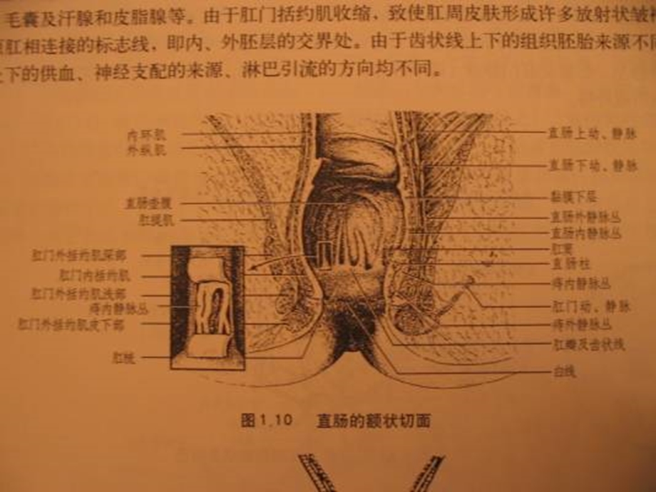 医疗知识培训你医院外科培训肛管职场疾病知识培训.ppt_第3页