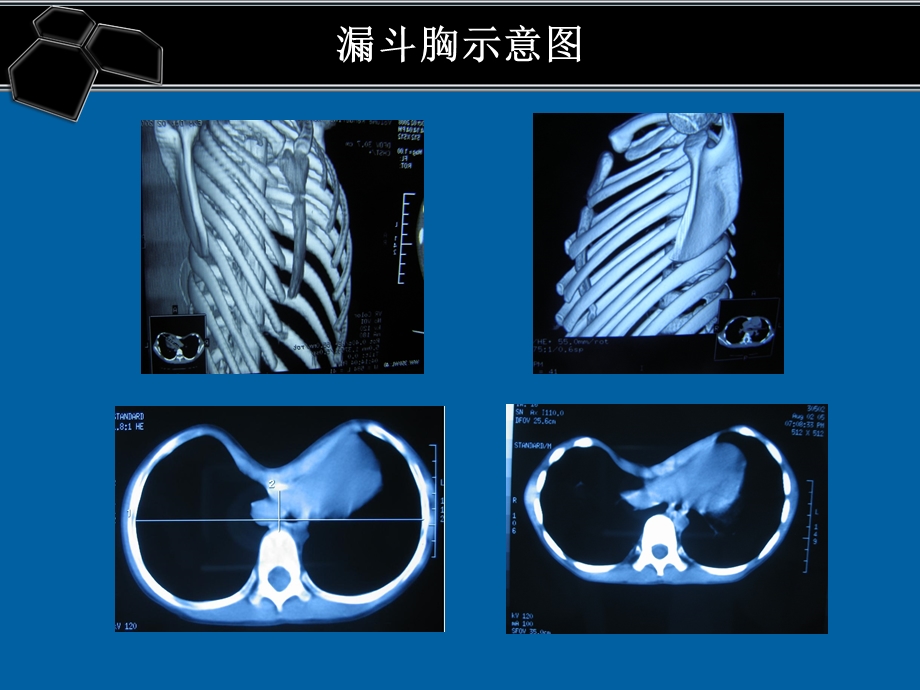 医院手术常见并发症处理及预防1.ppt_第2页