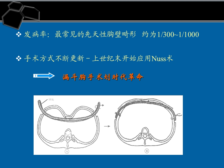 医院手术常见并发症处理及预防1.ppt_第3页