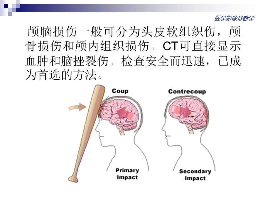 颅脑损伤的影像诊断.ppt_第2页