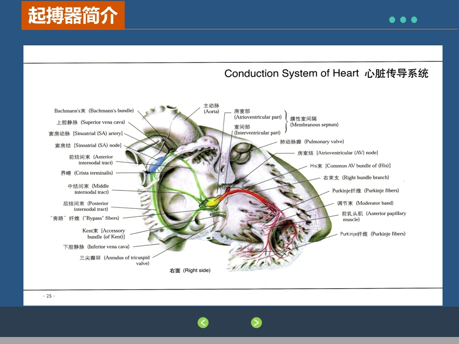 临时起搏器在外科患者围术期的应用.ppt_第3页