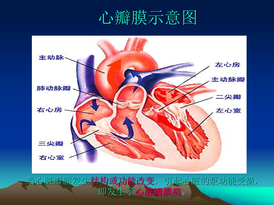 二尖瓣膜狭窄与换瓣治疗.ppt_第2页