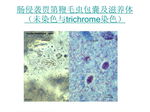 寄生虫切片.ppt