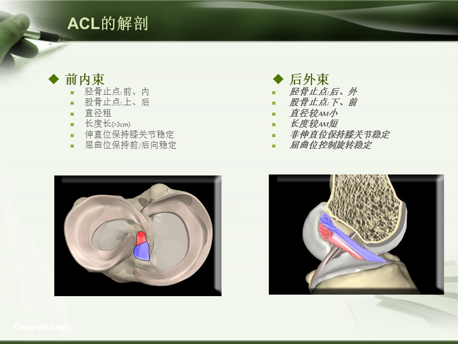 ACL损伤影像学诊断.ppt_第3页