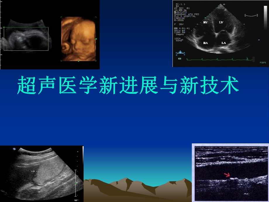 (完整版)超声医学临床应用.ppt_第1页