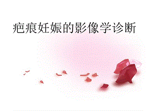 3.疤痕妊娠的影像学诊断姚穗.ppt