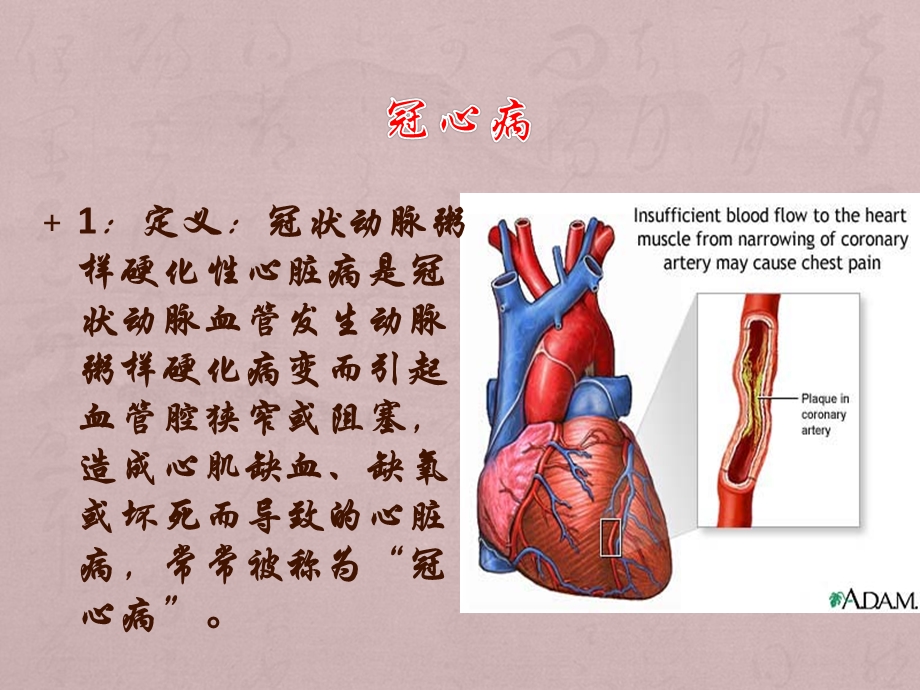 冠心病的规范化治疗.ppt_第3页