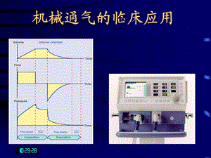 呼吸机临床应用基础知识.ppt