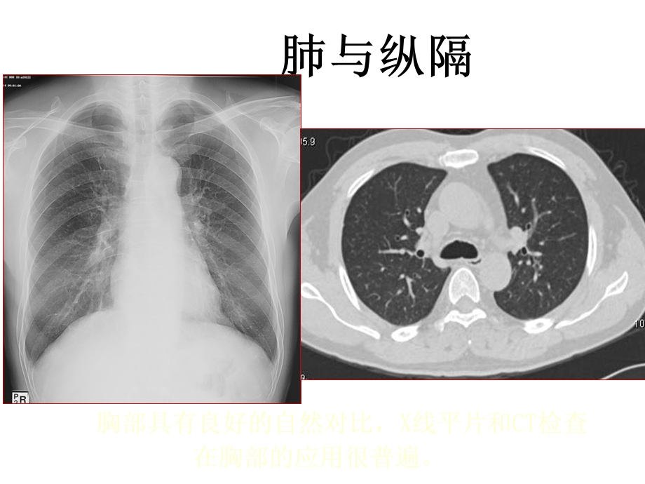 呼吸系统影像学胸部正常影像.ppt_第2页