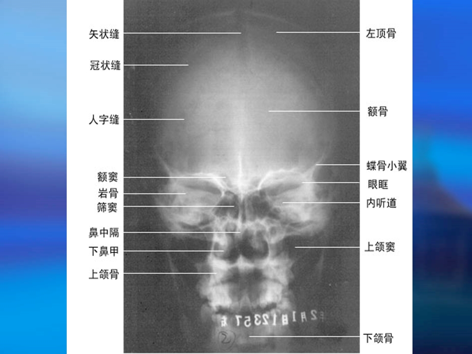 影像学中枢神经系统.ppt_第3页