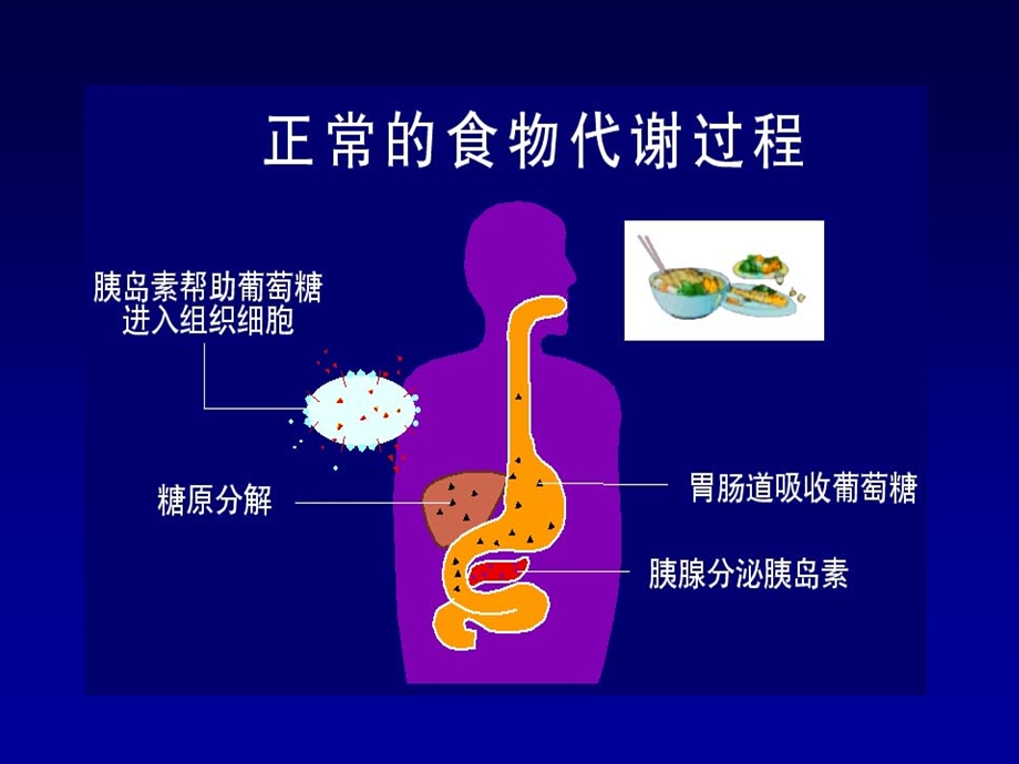 糖尿病饮食管理.ppt_第2页