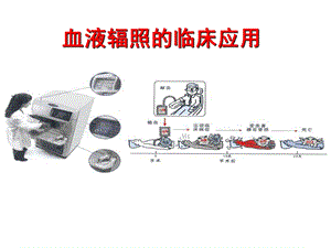 血液辐照临床的应用.ppt