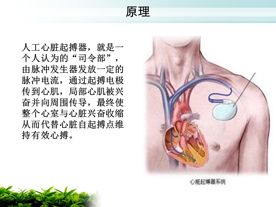 起搏器植入术的健康教育.ppt_第3页