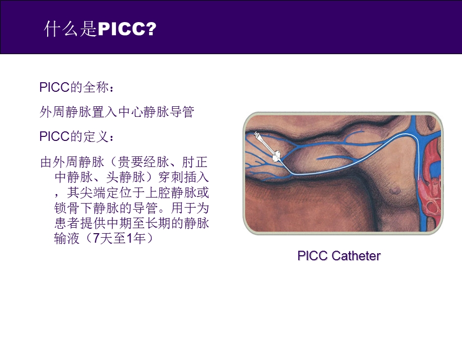 PICC培训课件.ppt_第2页