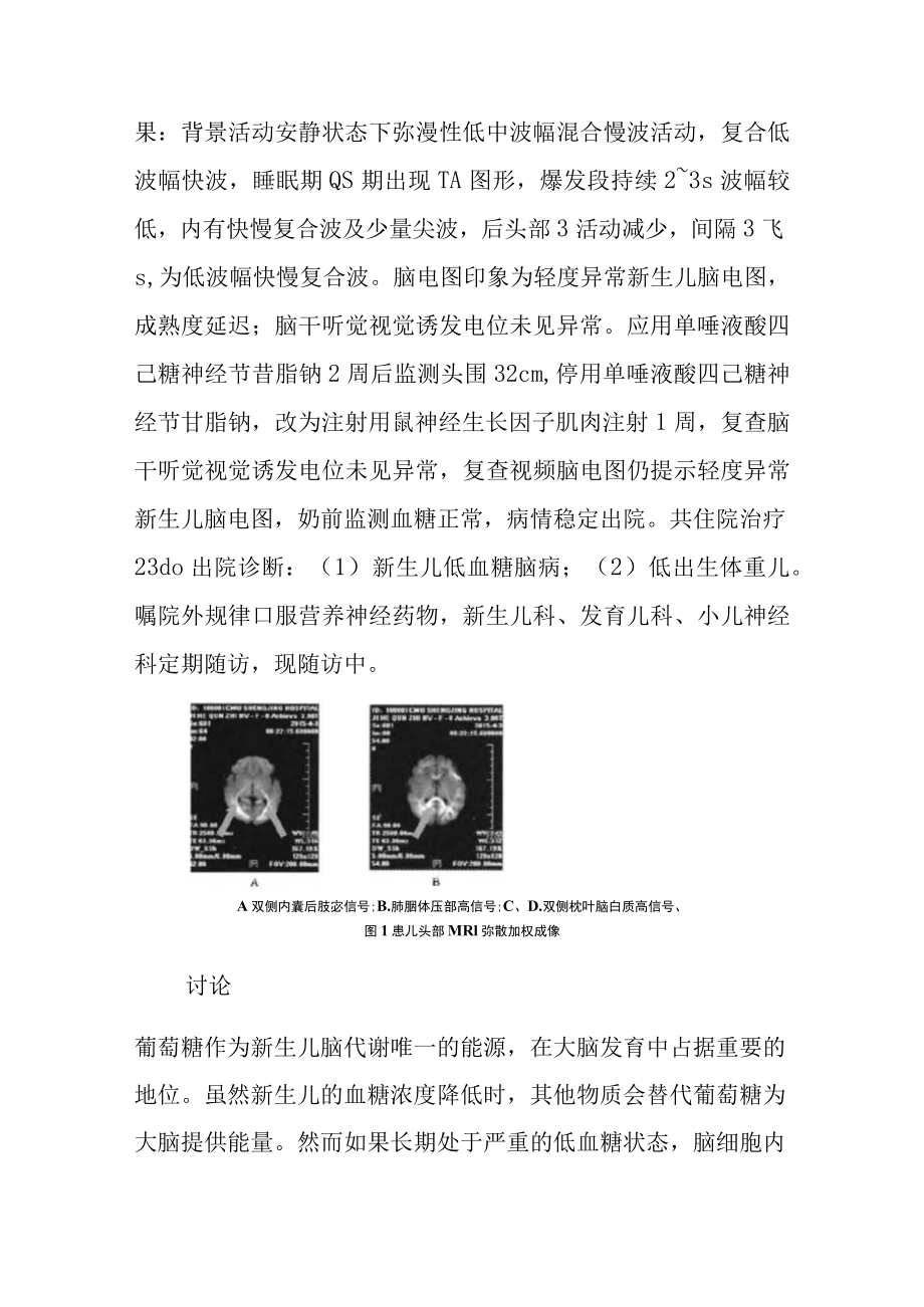 新生儿低血糖脑病病例分析专题报告.docx_第3页