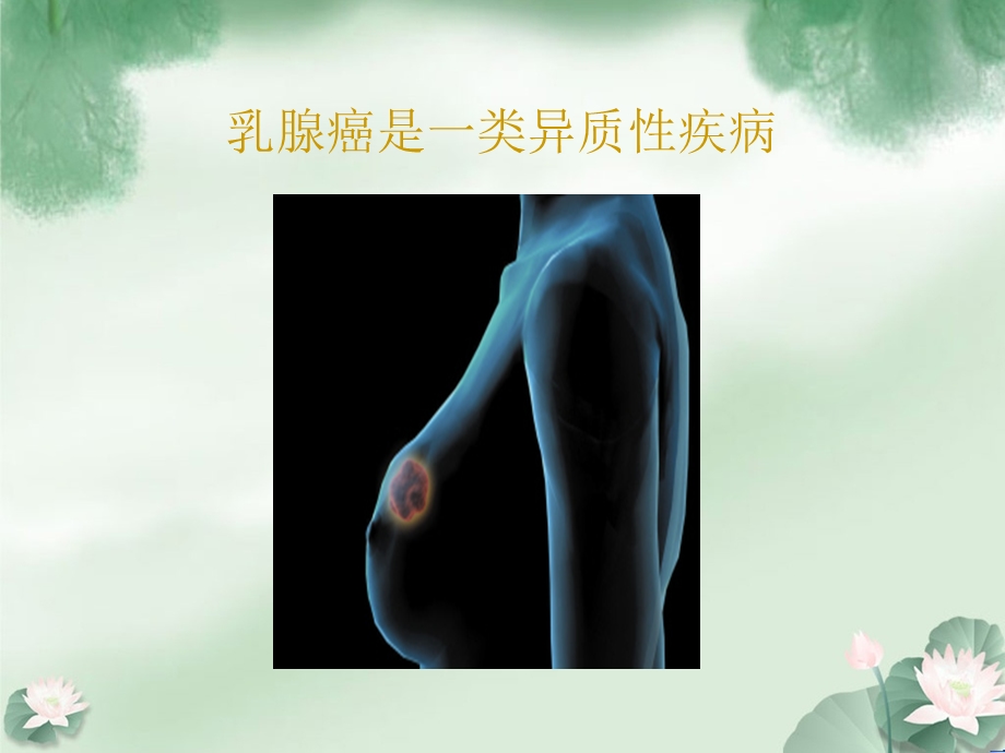 乳腺癌病例讨论.ppt_第2页