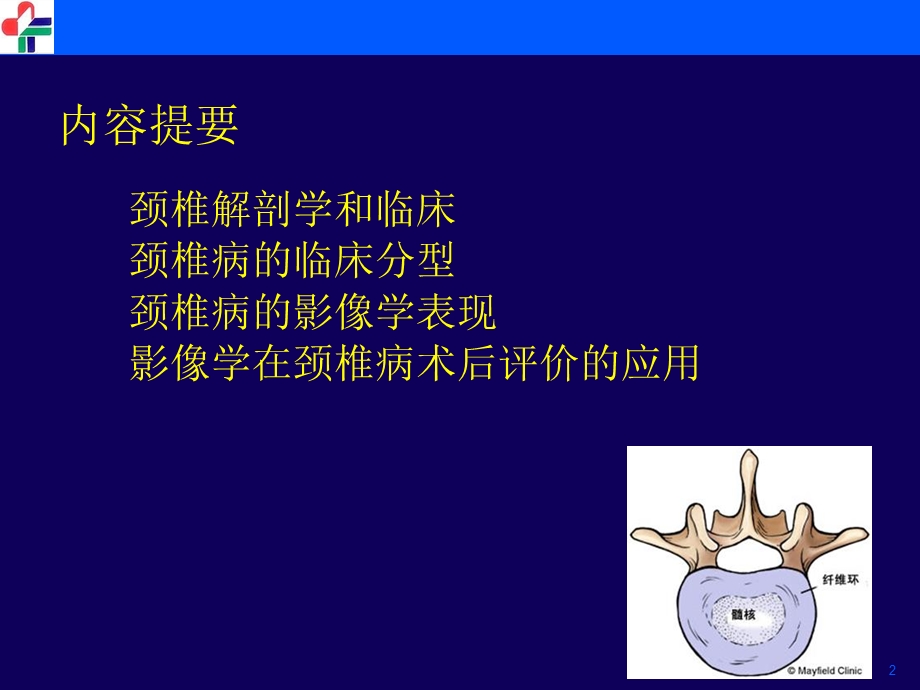 颈椎病临床和影像学诊断刘修.ppt_第2页