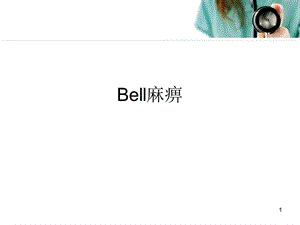 bell麻痹医学PPT课件.ppt