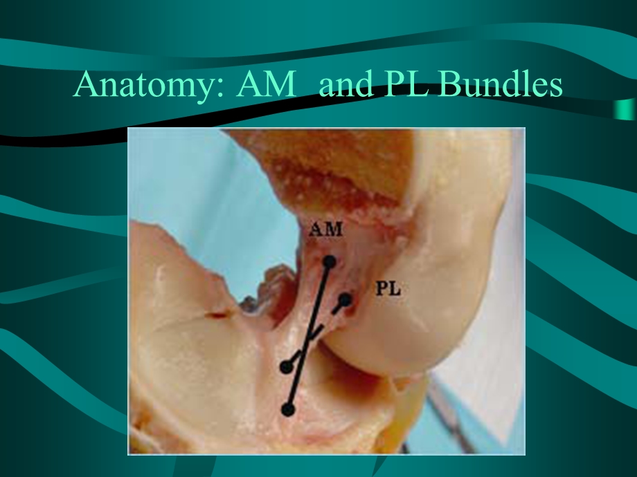 【医学英文课件】ACLReconstruction.ppt_第3页