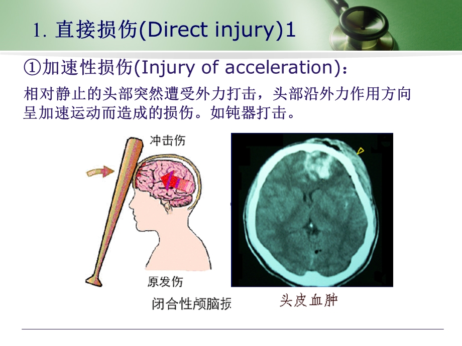 【医学课件】颅脑损伤.ppt_第3页