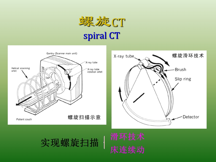 医学影像读片指南PPT课件.ppt_第3页